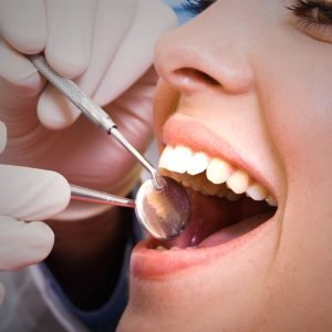 burnaby routine dental cleaning