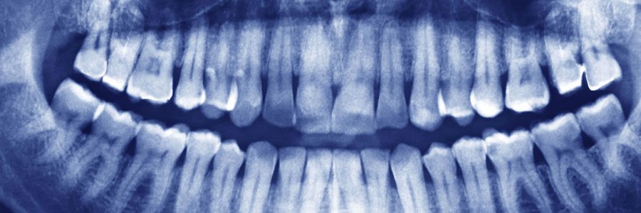 burnaby dental x ray