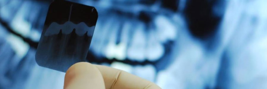 burnaby dentist x-ray